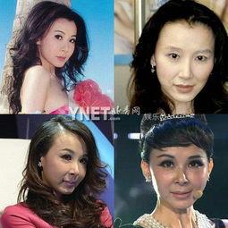 整容变丑的女明星,整容变丑的女明星警示录