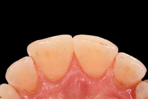 前牙有缝隙的明星,揭秘前牙缝隙的明星风采